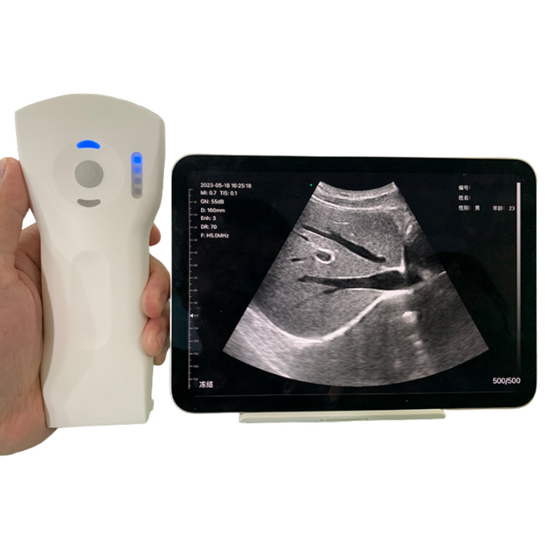 Ultrassom Portátil Doppler 3 em 1 192E Sonostar 8CPL Veterinário