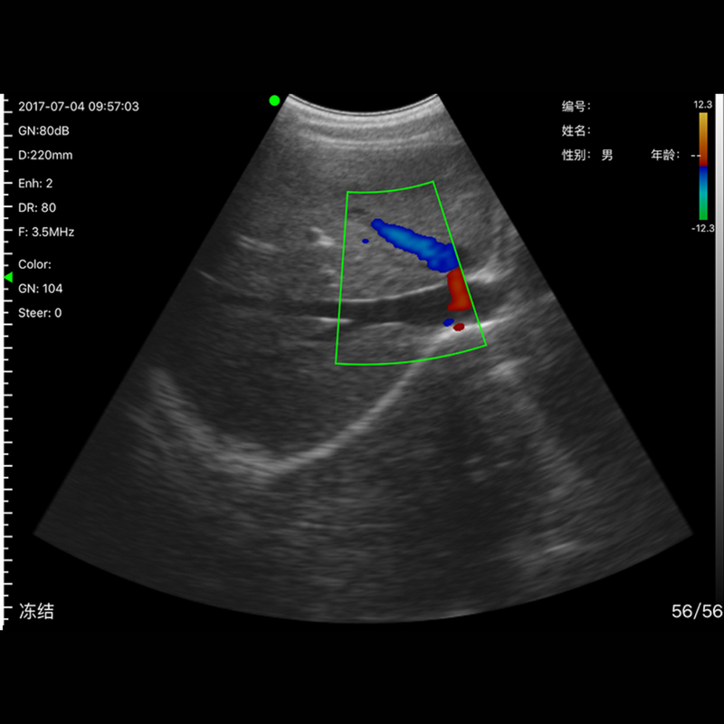 Imagem Ultrassom Portátil Doppler Convexo 128E EM-5C Veterinário