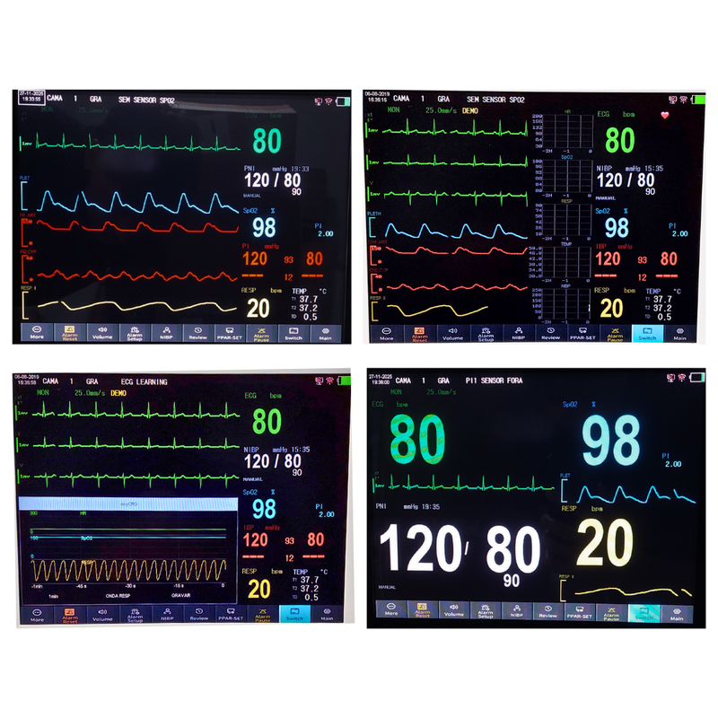 Monitor Multiparamétrico 12" EV-MM12 Veterinário
