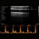Imagem Ultrassom Portátil Doppler Linear 192E EM-6L Veterinário