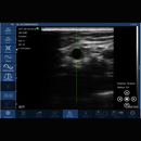 Imagem Ultrassom Portátil Doppler Linear 192E EM-6L Veterinário