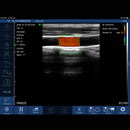 Imagem Ultrassom Portátil Doppler Linear 192E EM-6L Veterinário