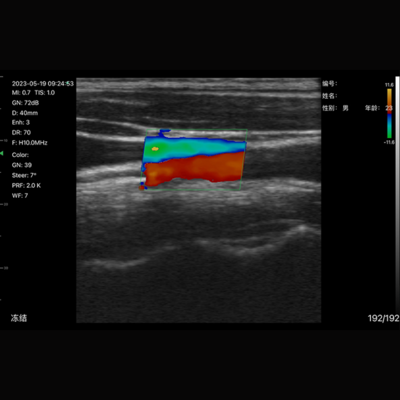 Imagem Ultrassom Portátil Doppler Linear 192E EM-8L Veterinário