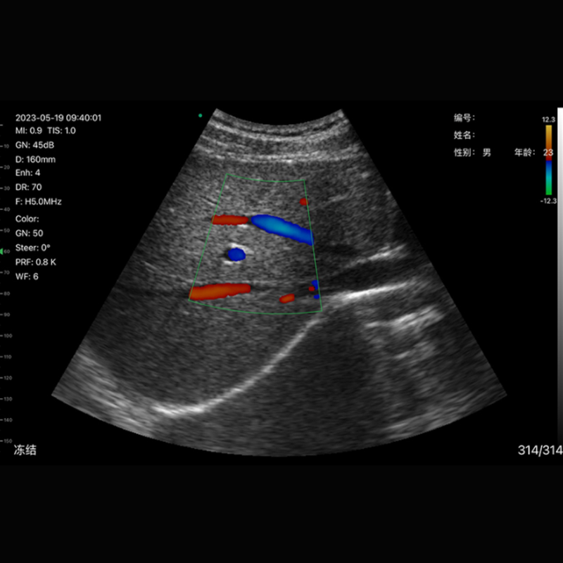 Imagem Ultrassom Portátil Doppler 3 em 1 192E EM-8CPL Veterinário