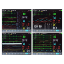 Monitor Multiparamétrico 8" EV-MM8 Veterinário