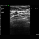 Imagem Ultrassom Portátil Doppler 2 em 1 128E EM-5MN Veterinário