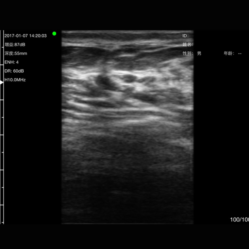 Imagem Ultrassom Portátil Doppler 2 em 1 128E EM-5MN Veterinário