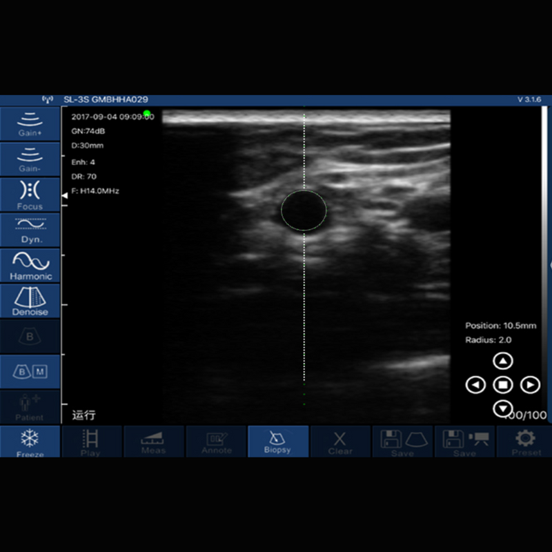 Ultrassom Portátil Doppler 2 em 1 128E Sonostar 5P Veterinário