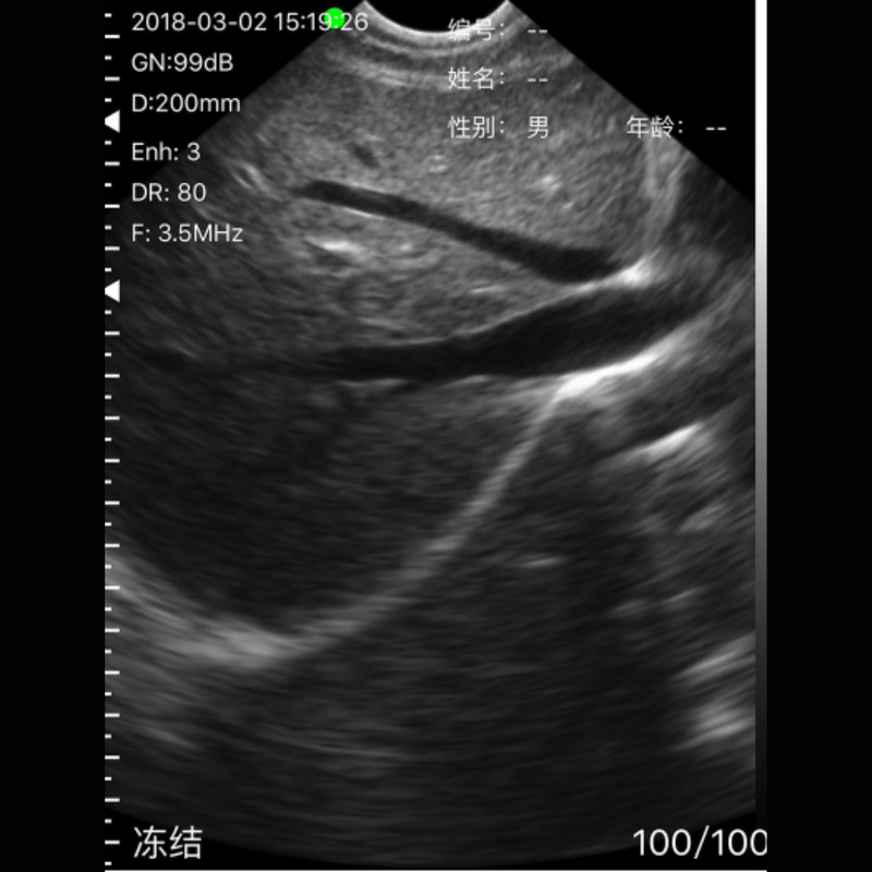 Ultrassom Portátil Doppler 3 em 1 128E Sonostar 5MN Veterinário