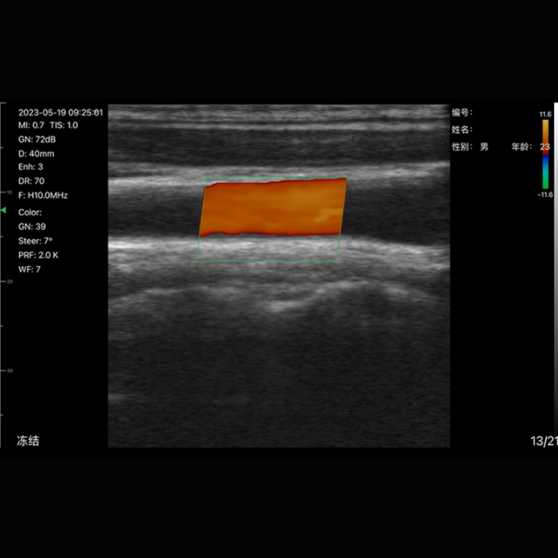 Ultrassom Portátil Doppler 3 em 1 192E Sonostar 8CPL Veterinário