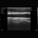 Imagem Ultrassom Portátil Doppler Linear 192E EM-8L Veterinário