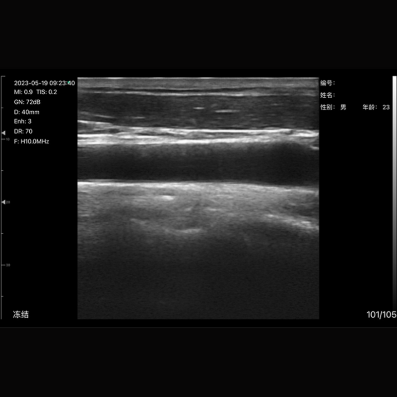 Imagem Ultrassom Portátil Doppler Linear 192E EM-8L Veterinário