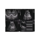 Ultrassom Portátil 12.1" EV-UT2 Veterinário