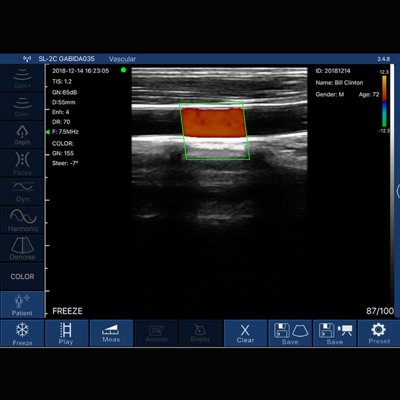 Ultrassom Portátil Doppler Linear UHF 128E EM-5P Veterinário