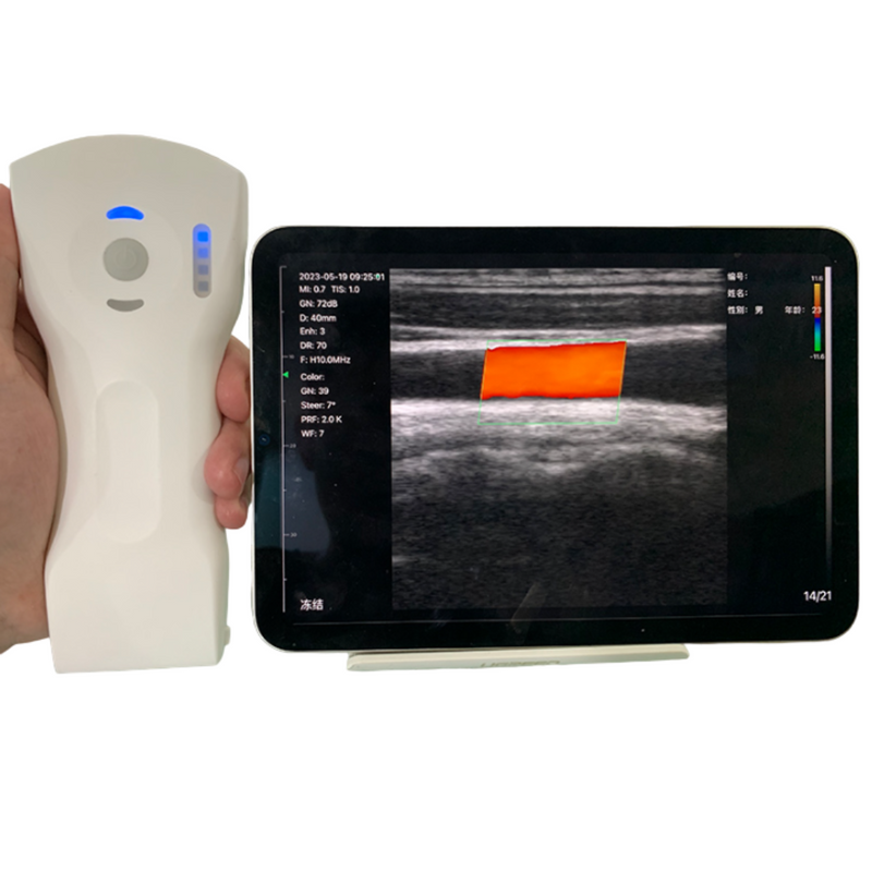 Ultrassom Portátil Doppler 3 em 1 192E EM-8CPL Veterinário