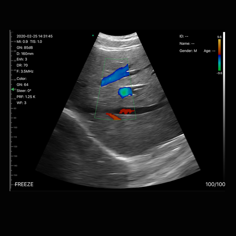 Ultrassom Portátil 3 em 1 Colorido 128E Sonostar 5CPL Veterinário