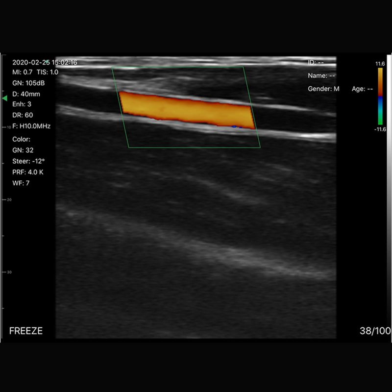 Imagem Ultrassom Portátil Doppler 3 em 1 128E EM-5CPL Veterinário