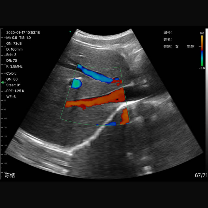 Imagem Ultrassom Portátil Doppler 3 em 1 192E EM-6CPL Veterinário