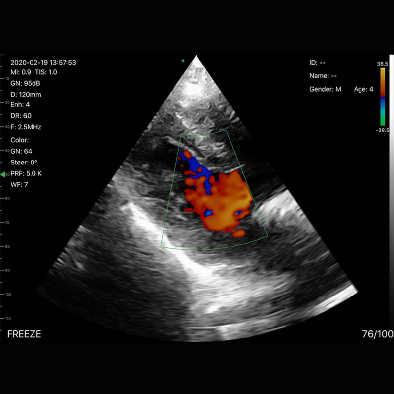 Imagem Ultrassom Portátil Doppler 3 em 1 192E EM-6CPL Veterinário