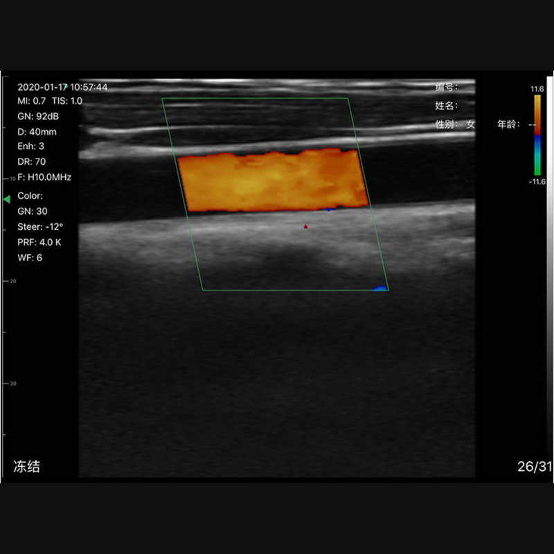 Imagem Ultrassom Portátil Doppler 3 em 1 192E EM-6CPL Veterinário