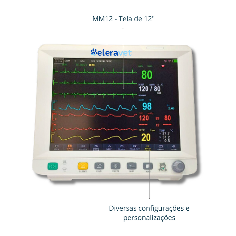Monitor Multiparamétrico 12" EV-MM12 Veterinário