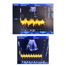 Ultrassom Portátil 15" EV-US3 Veterinário