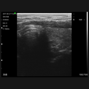 Imagem Ultrassom Portátil Linear 80E EM-3L Veterinário