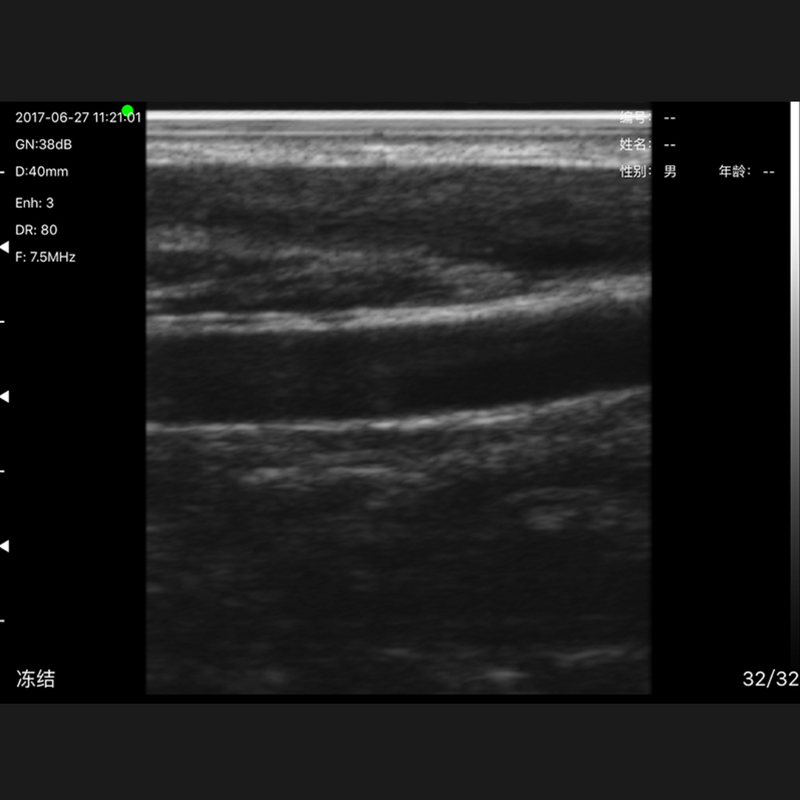 Imagem Ultrassom Portátil Linear 80E EM-3L Veterinário