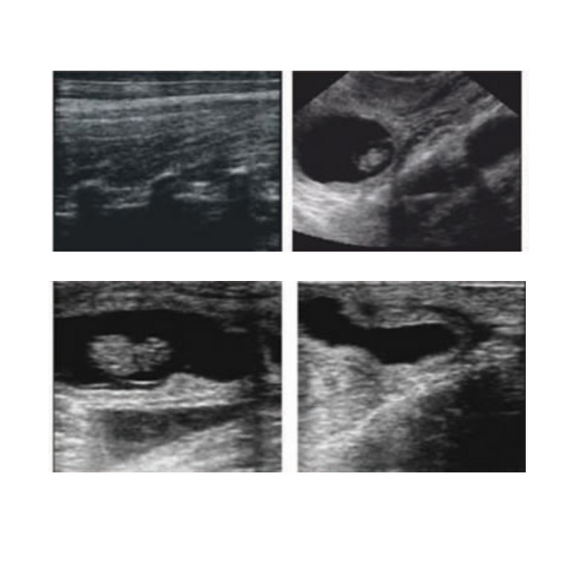 Ultrassom Portátil com Tela 5,6" EM-UT56 Veterinário