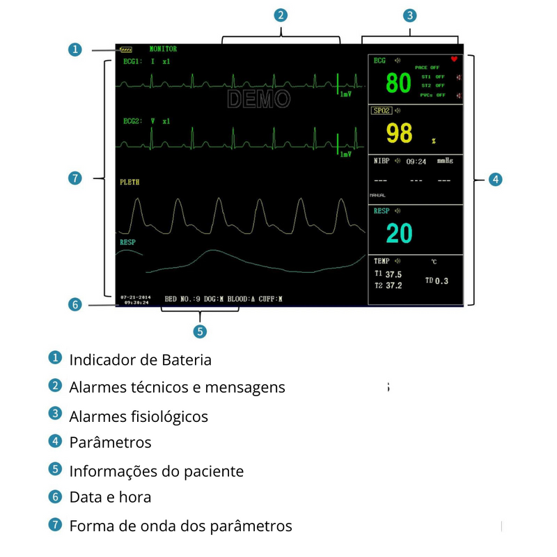 Monitor de Sinais Vitais 8" Contec CMS6000 Veterinário