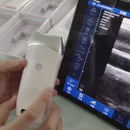 Video Ultrassom Portátil Linear 80E EM-3L Veterinário